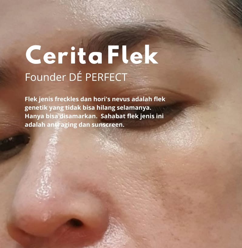 Cerita Flek Owner flek - cerita dan pengalaman owner