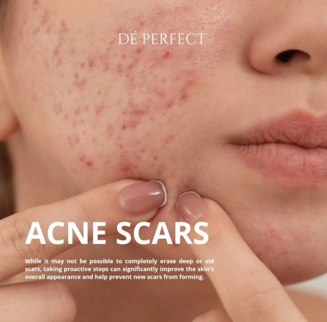 SCARS BOPENG SCARS OR BOPENG