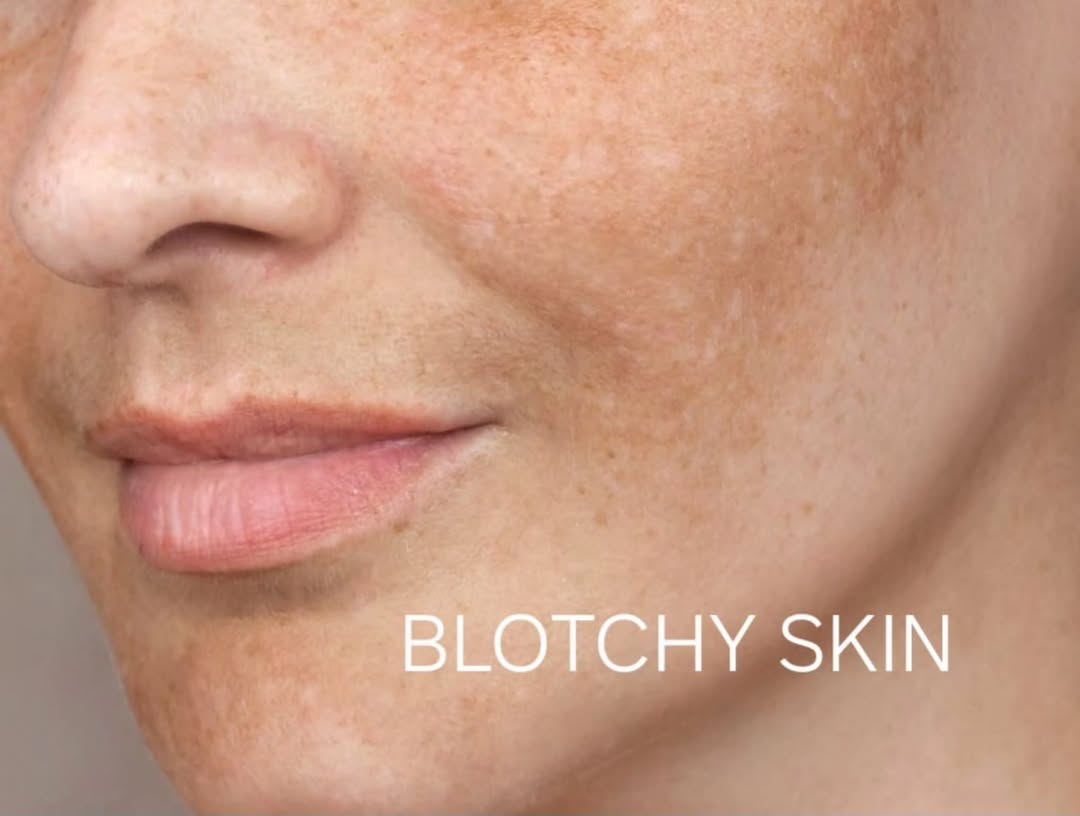 Kulit Bernoda Kulit Bernoda