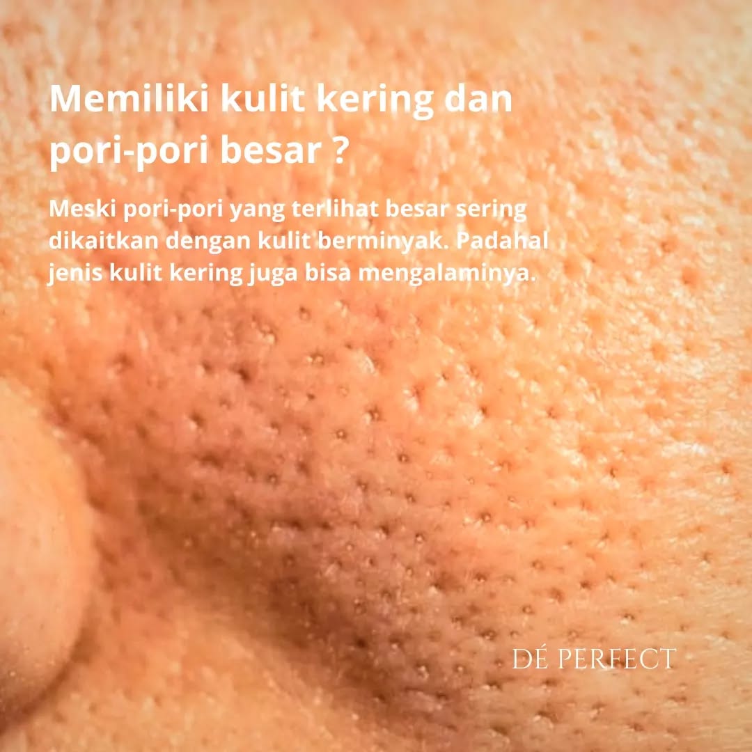 Memiliki kulit kering dan pori-pori besar memiliki kulit kering dan pori-pori