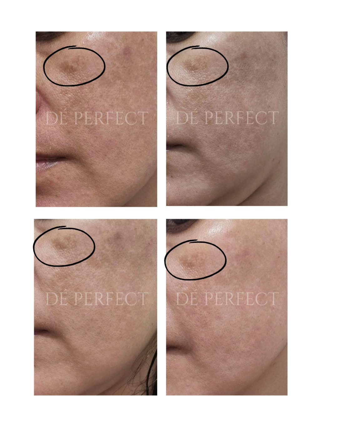 bahagia menemukan kembali kulit sehatnya bahagia menemukan kembali kulit sehatnya