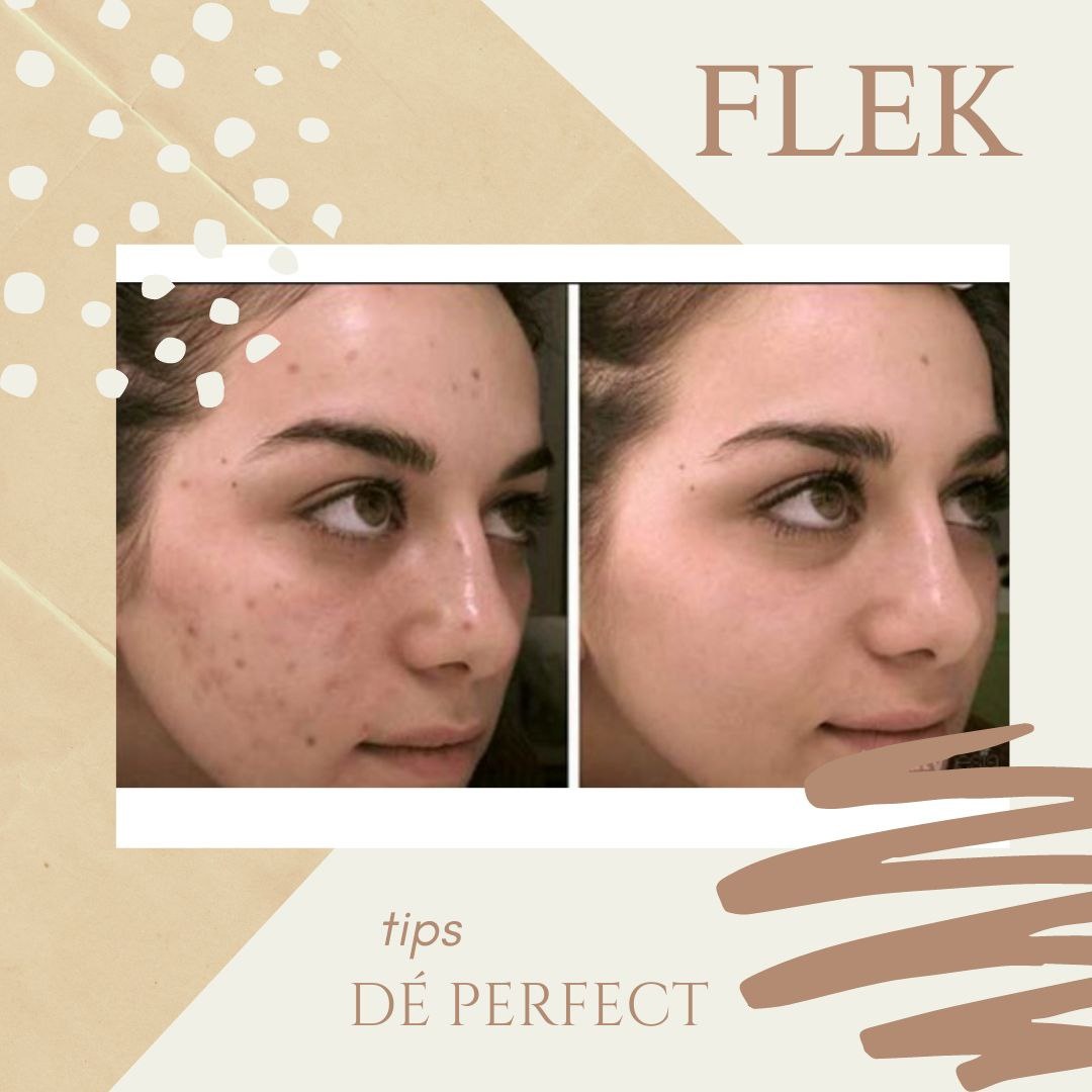 Fle Flek