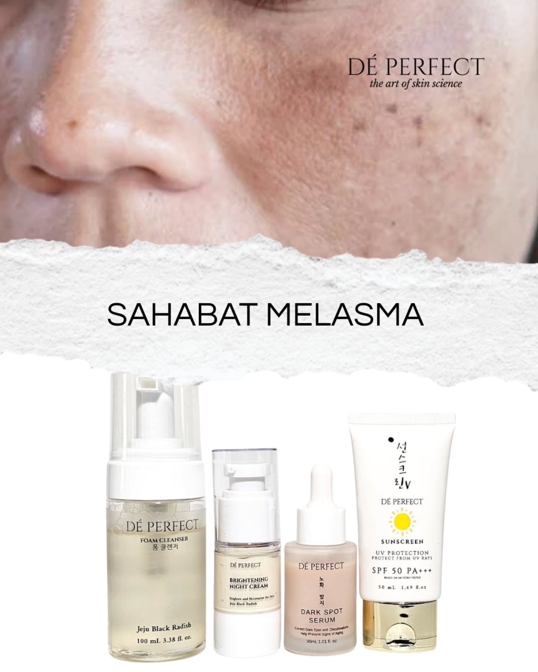 sahabat melasma sahabat melasma