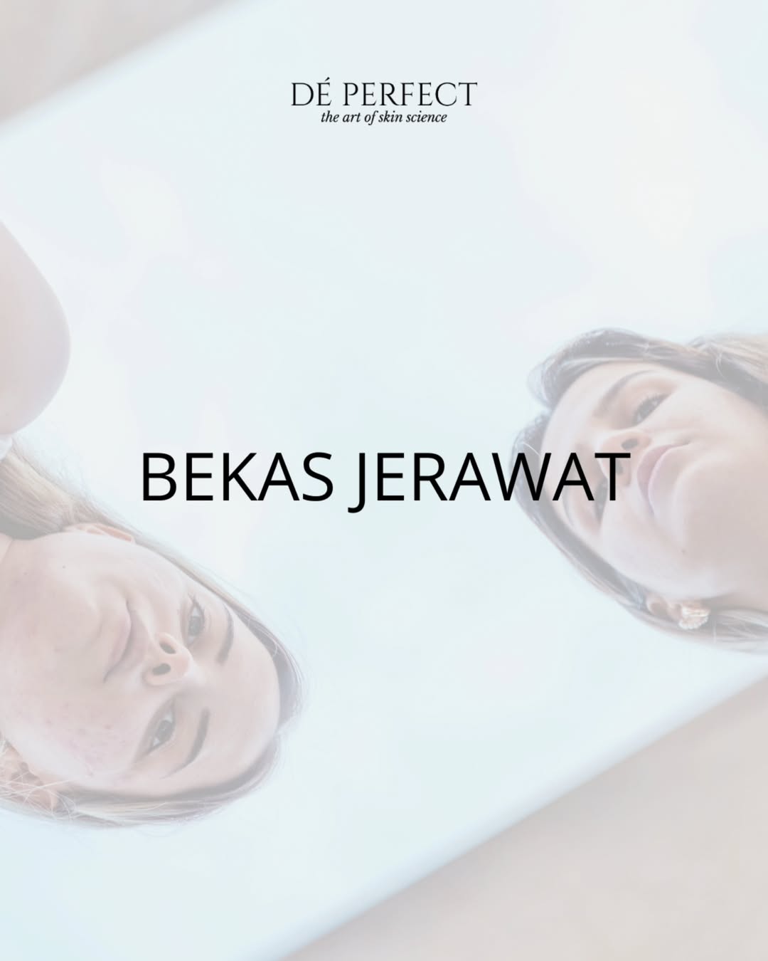cara mengatasi bekas jerawat
